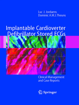 cover image of Implantable Cardioverter Defibrillator Stored ECGs